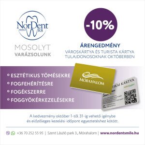 Városkártya és Turista kártya kedvezmény a NorDent Smile Kft-nél